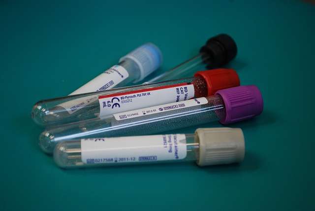 five vacutainer blood collection tubes diagnosing rare blood disorders